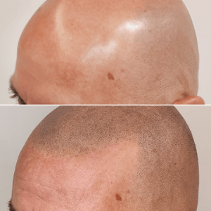 antes-despues-efecto-3d-4