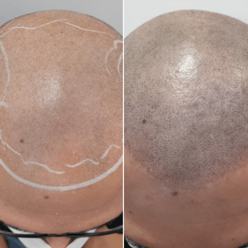 antes-despues-efecto-3d-clientes-riezu-bilbao