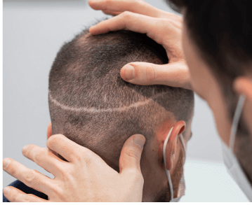 micropigmentacion-clientes-bilbao-3
