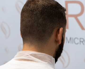 micropigmentacion-clientes-bilbao
