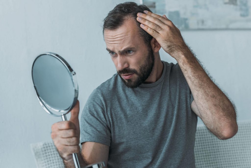 alopecia y autoestima en Bilbao